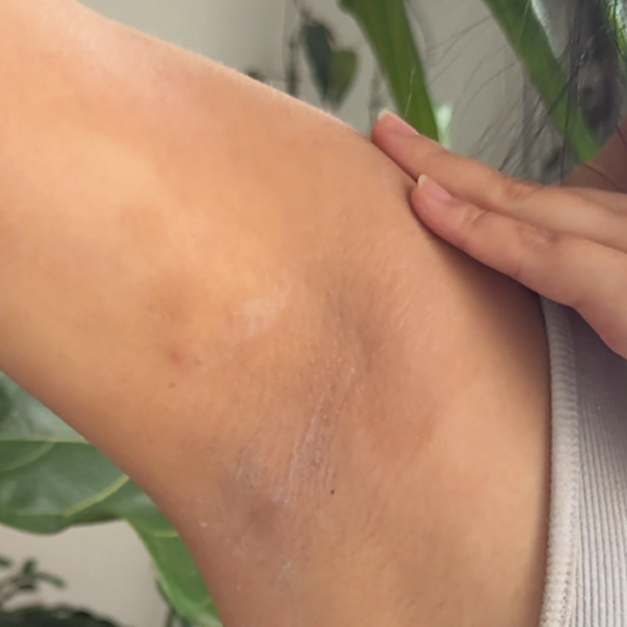 Calm, clear underarm skin two weeks after switching to MAGS Skin